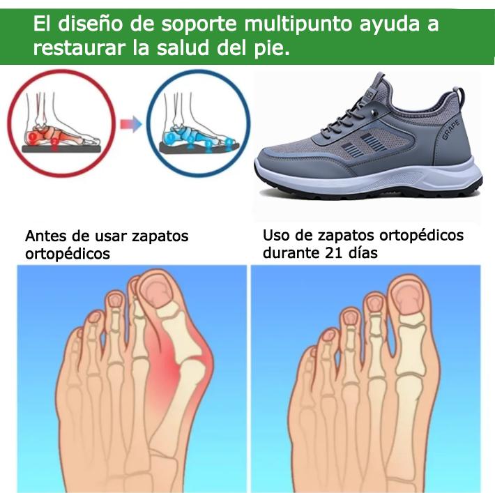 FOUNNE® 【🔥Oferta especial de hoy: 60% de descuento🎁】Zapatillas cómodas para caminar | Zapatillas ligeras y duraderas👟 | Camina sin fatiga durante todo el día | Soporte para el arco del pie | Alivia eficazmente los problemas de los pies✅