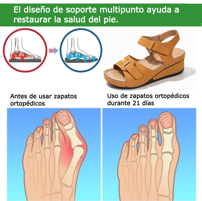 Sandalias ortopédicas FOUNNE® 【🔥50% de descuento hoy🎁】 Sandalias de verano👡✅ Diseño con velcro✅ Alivia el dolor de pies✅ Soporte para el arco: Comodidad todo el día👟