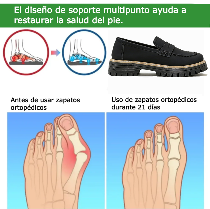 Founne® 【⏰¡Hoy a mitad de precio!👟】Estos zapatos son ideales para actividades durante todo el día | Diseño con soporte para el arco | Alivian eficazmente la fatiga | Alivian el dolor de pies | Mayor resistencia al deslizamiento👞