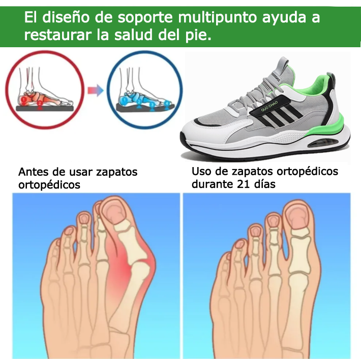 Founne® 【🔥¡Hoy a mitad de precio! ⏰】Comodidad para caminar todo el día | Diseño con soporte para el arco | Súper amortiguación | Alivia el dolor de pies | Impermeable y antideslizante | Corrige la marcha👟