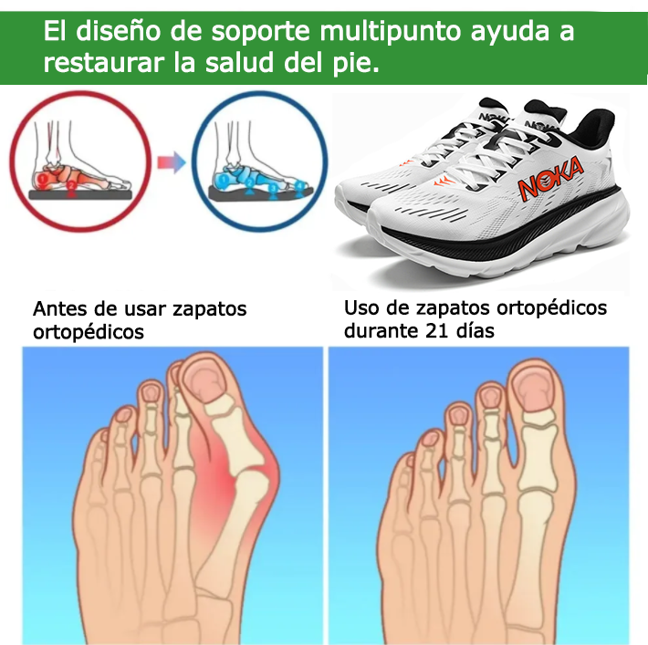Zapatos ortopédicos Founne® [🎁¡Hoy a mitad de precio🔥]Zapatillas deportivas cómodas 👟 Transpirables y frescas | Diseño con soporte para el arco | Alivian eficazmente el dolor de pies✅
