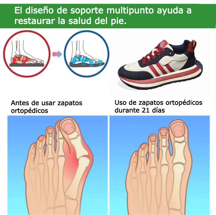 Founne® 【⏰50% de descuento hoy🔥】 Zapatos para caminar | Diseño con soporte para el arco | Reduce la presión del pie | Mejora la línea de las piernas | Cómodos y sin dolor