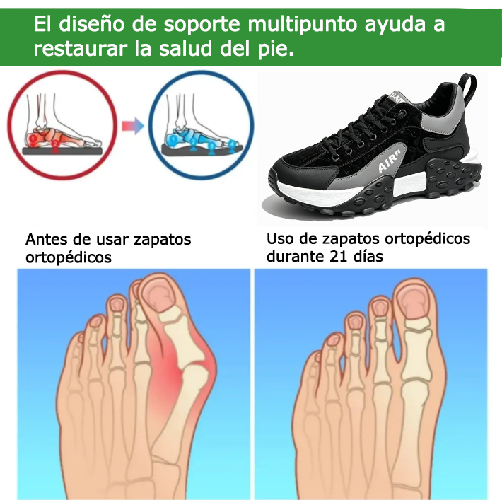 FOUNNE® 【🔥Oferta especial de hoy: 60% de descuento🎁】Zapatillas cómodas para caminar | Zapatillas ligeras y duraderas👟 | Camina sin fatiga durante todo el día | Soporte para el arco del pie | Alivia eficazmente los problemas de los pies✅