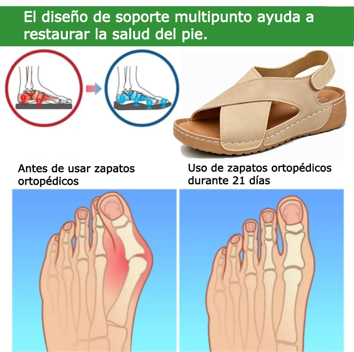 Zapatos ortopédicos FOUNNE® 【🔥60% de descuento hoy🎁】Ideales para salidas de verano👡 | Suaves y cómodos | Diseño con soporte para el arco del pie | Alivian eficazmente la fatiga y el dolor | Mayor resistencia al deslizamiento✅