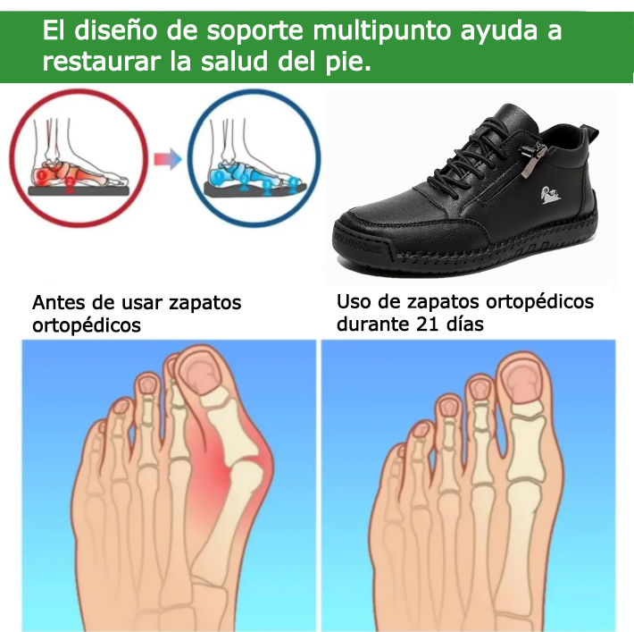 Founne® 【🔥¡Hoy a mitad de precio! ⏰】Comodidad para caminar todo el día | Diseño con soporte para el arco | Súper amortiguación | Alivia el dolor de pies | Impermeable y antideslizante | Corrige la marcha👟