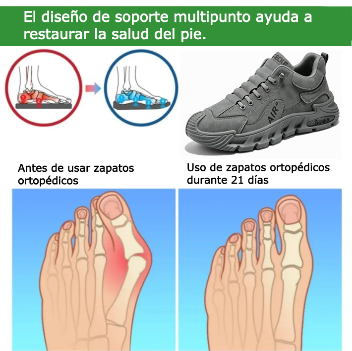 Founne® 【🔥¡Hoy a mitad de precio! ⏰】Comodidad para caminar todo el día | Diseño con soporte para el arco | Súper amortiguación | Alivia el dolor de pies | Impermeable y antideslizante | Corrige la marcha👟