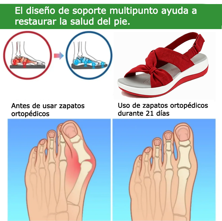 Zapatos ortopédicos FOUNNE® [🔥50% de descuento hoy🎁] Sandalias ergonómicas para mujer | Soporte para el arco del pie que mejora la forma de las piernas | Alivia fácilmente el dolor de pies🦶