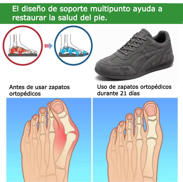 Founne® 【🔥¡Hoy a mitad de precio! ⏰】Comodidad para caminar todo el día | Diseño con soporte para el arco | Súper amortiguación | Alivia el dolor de pies | Impermeable y antideslizante | Corrige la marcha👟