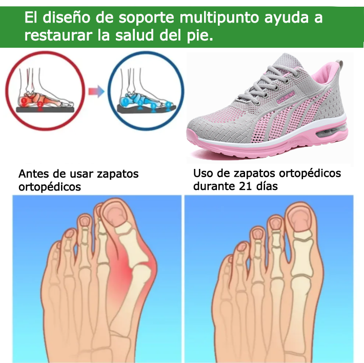 Founne®【⏰50% de descuento hoy🔥】Calzado ortopédico | Diseño ergonómico | Alivia el dolor de espalda, pies y articulaciones | Comodidad durante todo el día