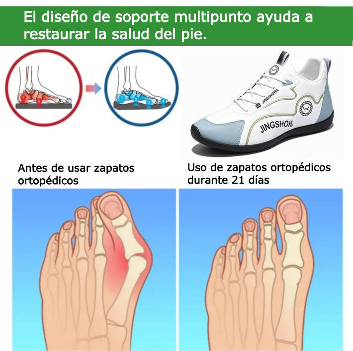 Founne® 【🔥¡Hoy a mitad de precio! ⏰】Comodidad para caminar todo el día | Diseño con soporte para el arco | Súper amortiguación | Alivia el dolor de pies | Impermeable y antideslizante | Corrige la marcha👟