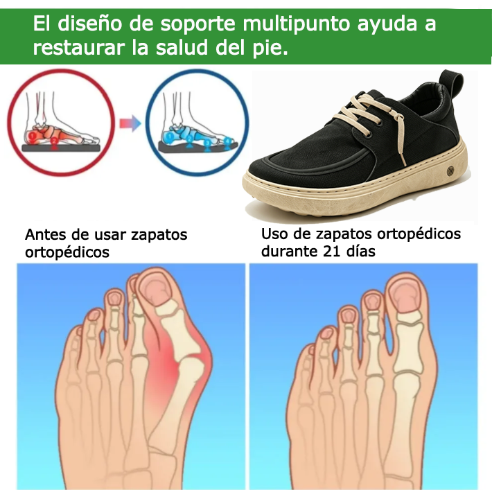 FOUNNE® 【🔥¡Hoy a mitad de precio!⏰】✅ Zapatos ortopédicos de alta calidad 🦶 Nuevo estilo 2026, impermeables y antideslizantes 🔴 Previenen problemas en los pies | Comodidad para caminar todo el día
