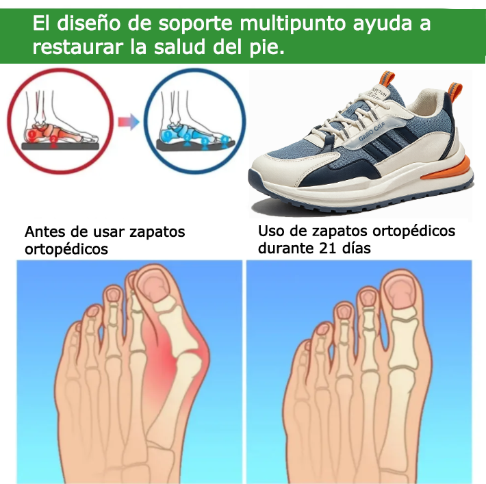 Zapatos ortopédicos FOUNNE® [🔥¡Hoy a mitad de precio!🎁] Zapatos cómodos para caminar👟 Soporte para el arco | Alivia eficazmente los dolor de pie, dolor de arco, pies cansados✅