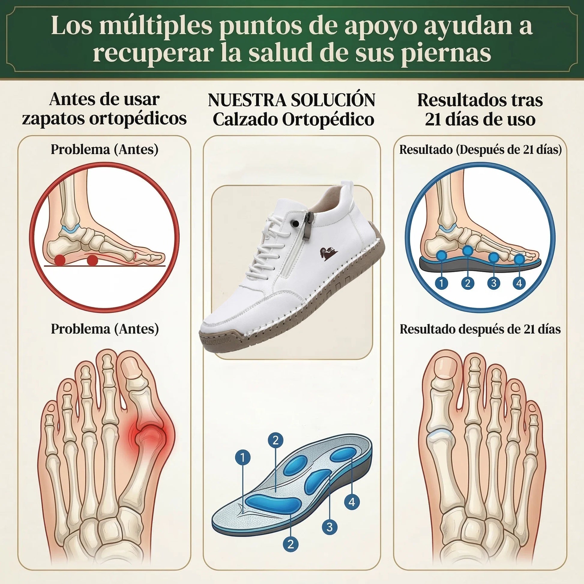 Founne® 【🔥¡Hoy a mitad de precio! ⏰】Comodidad para caminar todo el día | Diseño con soporte para el arco | Súper amortiguación | Alivia el dolor de pies | Impermeable y antideslizante | Corrige la marcha👟